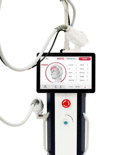 Secret Microneedling RF