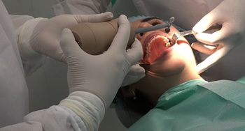 Tonsil stone removal device