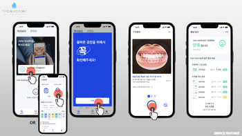 AI Oral hygiene management service based dental plaque check