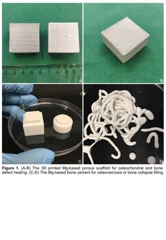 Magnesium-based orthopaedic implants, for a better joint