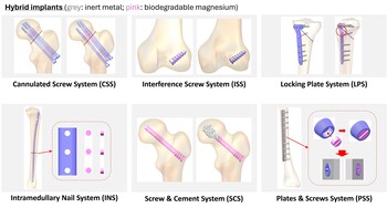 Hybrid implants for handling challenging bone disorders