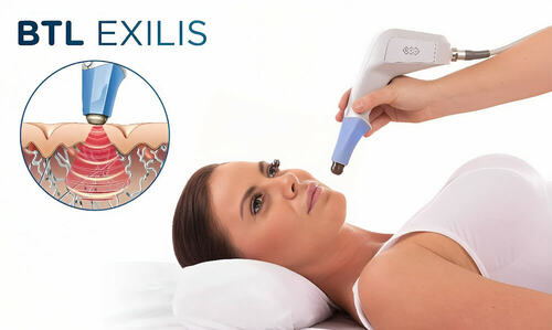 EXILIS®