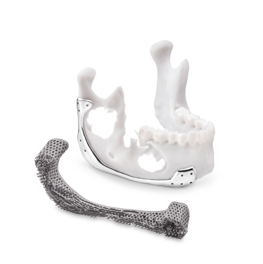 Polissage électrochimique / Electrochemical polishing