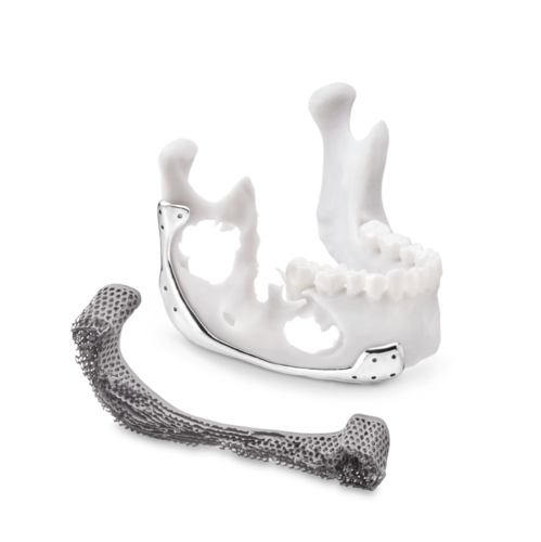 Polissage électrochimique / Electrochemical polishing