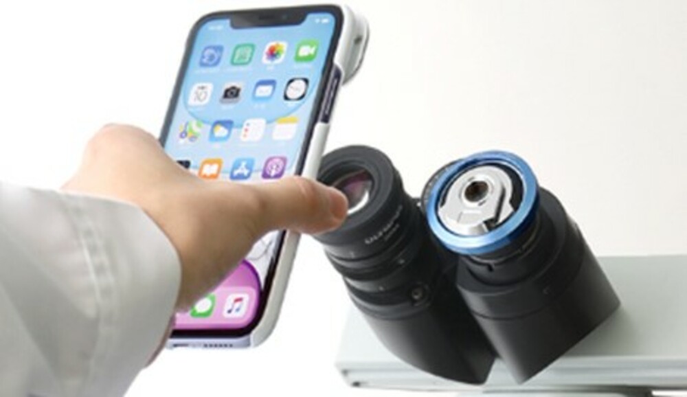 I-nter lens