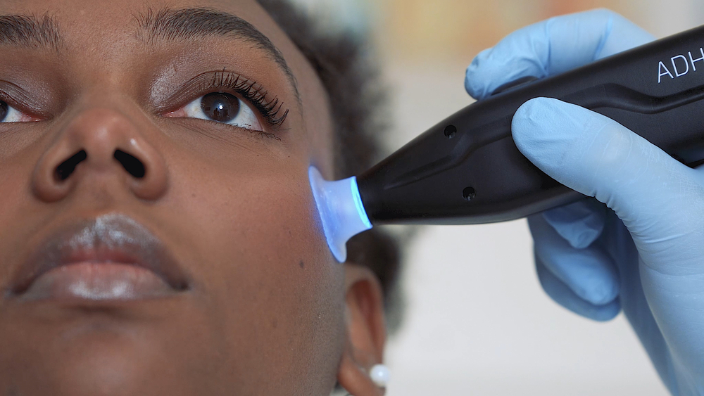 ADHELASKIN®: Instrumented Palpation to Reveal Skin Firmness, Suppleness, Adhesion and Elasticity