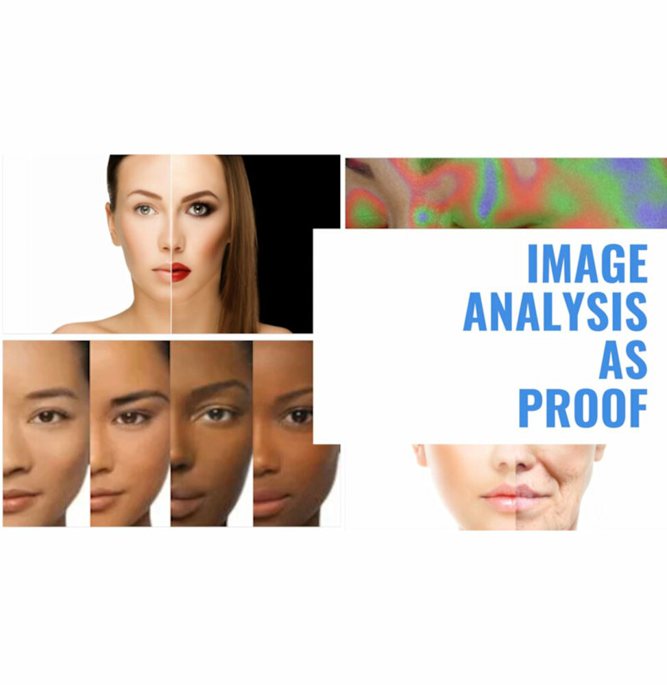 FrameScan 4 Std & Auto 3