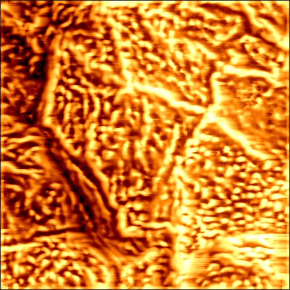 Topographical analysis of corneocytes using Atomic Force Microscopy
