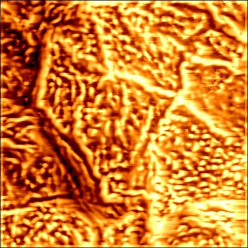 Topographical analysis of corneocytes using Atomic Force Microscopy