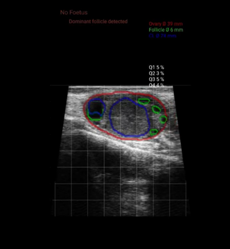 BovIntel Fertilité - Diagnostic assisté par imagerie pour la reproduction bovine.