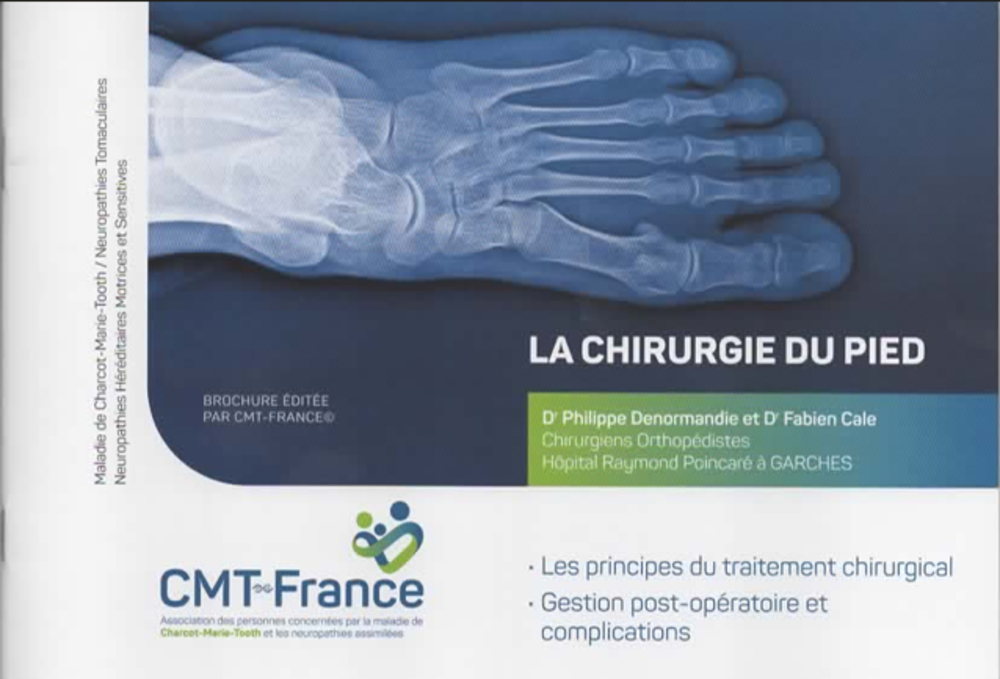 Brochure CMT et chirurgie du pied  