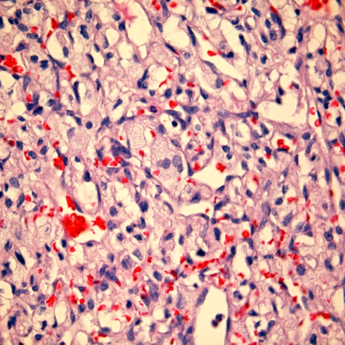 Master biomedical engineering