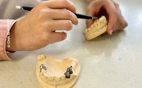 BTMS Technicien Qualifié en Prothèse Dentaire