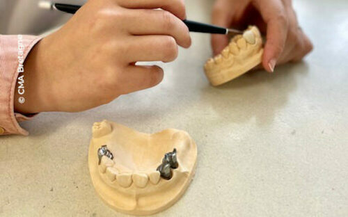 Bachelor Prothésiste Dentaire Pluridisciplinaire